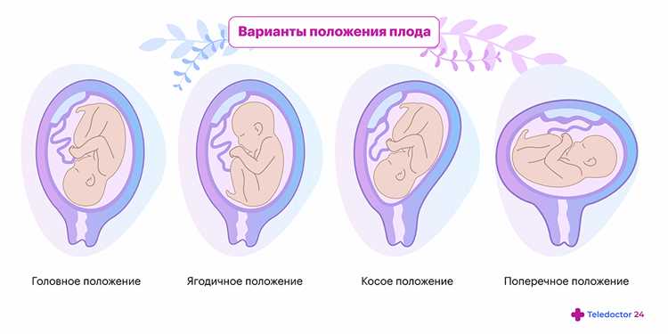 Влияние температуры и вентиляции на сон