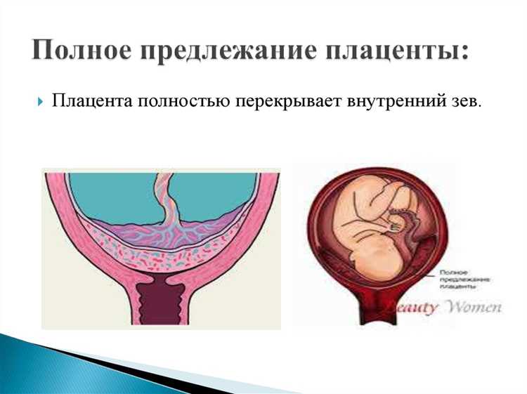 Методы клинического контроля и динамического наблюдения при аномальном расположении плаценты